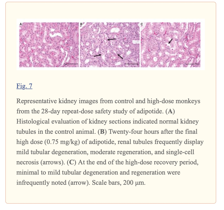 Kidney Images